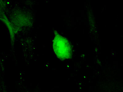 Retina tissue examined under fluorescent microscope after immunohistochemistry